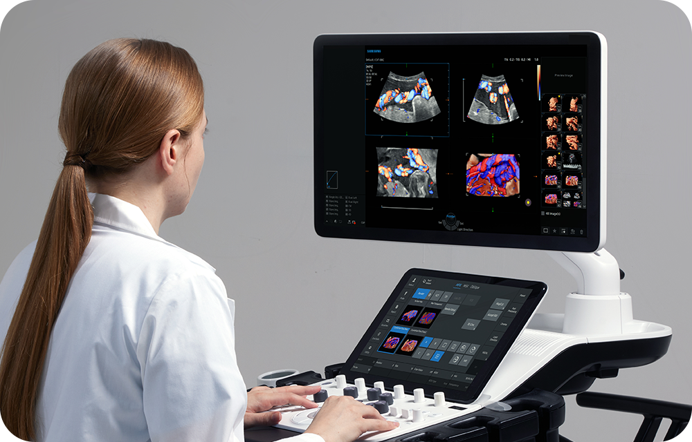 Ecografo Samsung V6 - Centro Medico Selene